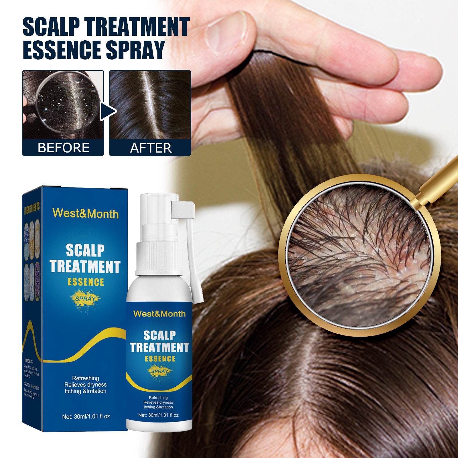 Scalp Treatment Essence Spray – Hair Growth & Hair Root Care