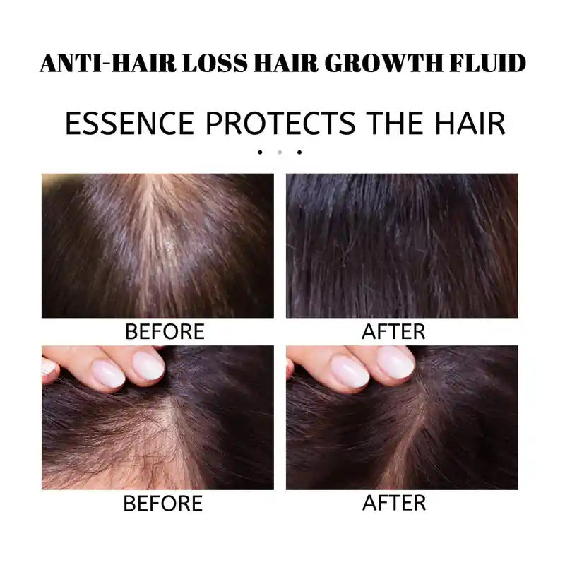 Rosemary Hair Growth Oil – Scalp Strengthening & Hair Care Treatment