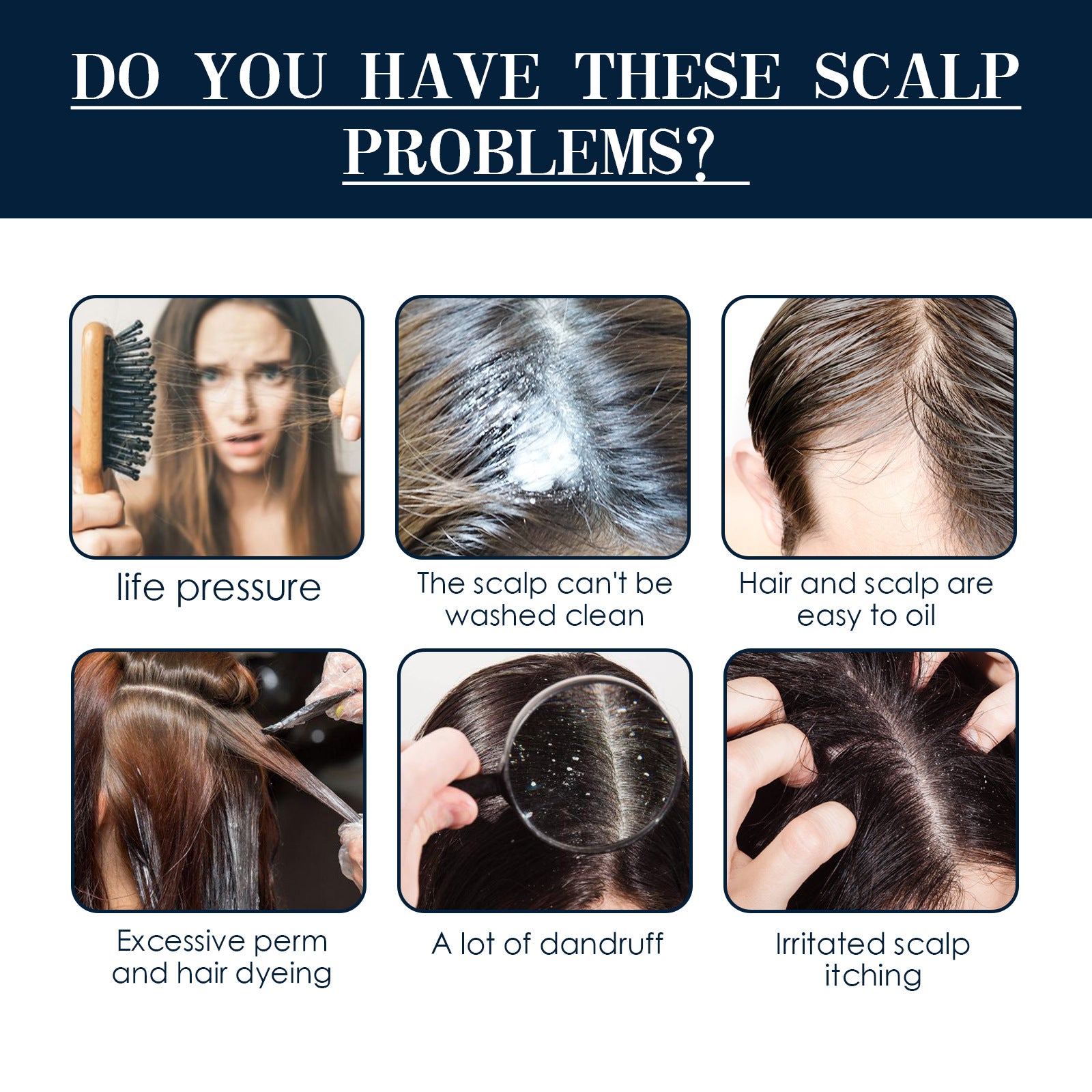 Scalp Treatment Essence Spray – Hair Growth & Hair Root Care