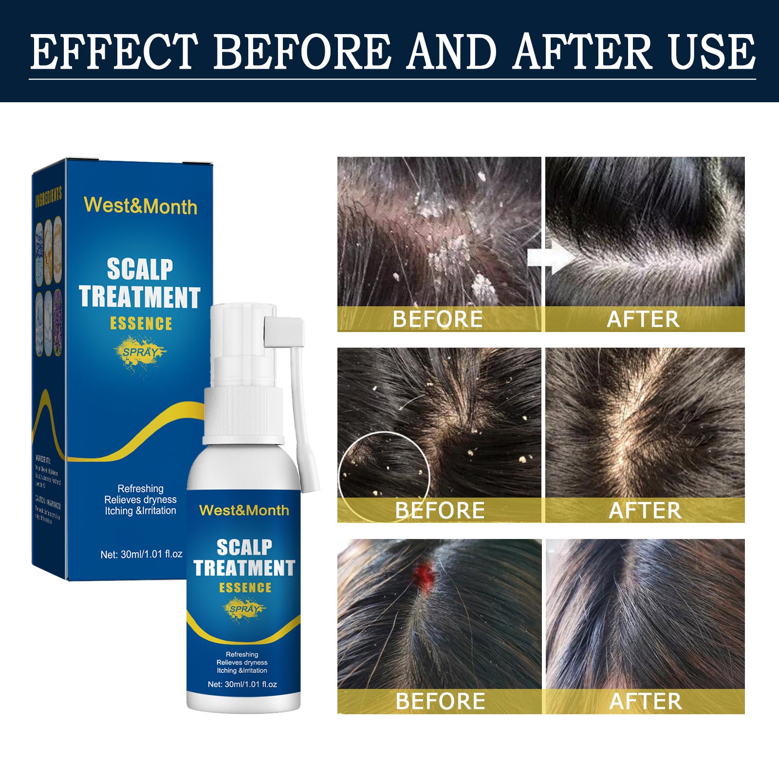 Scalp Treatment Essence Spray – Hair Growth & Hair Root Care